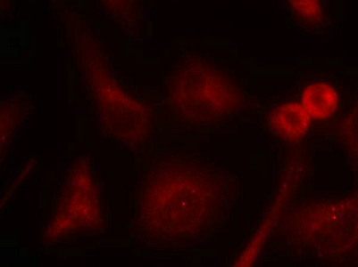 Immunofluorescence staining of methanol-fixed Hela cells using Shc1(Ab-349) Antibody.
