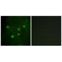 Immunofluorescence analysis of HUVEC cells, using BAF250B antibody.