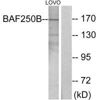 Western blot analysis of extracts from LOVO cells, using BAF250B antibody. Western blot analysis of extracts from LOVO cells, using BAF250B antibody.