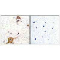 Immunohistochemical analysis of paraffin-embedded human brain tissue using NRG1 isoform-10 antibody.