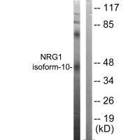 Western blot analysis of extracts from SKOV3 cells, using NRG1 isoform-10 antibody. Western blot analysis of extracts from SKOV3 cells, using NRG1 isoform-10 antibody.