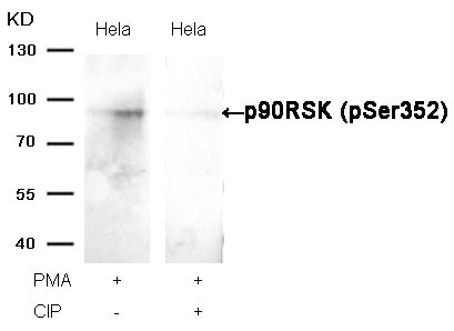 Western blot analysis of extracts from Hela cells, treated with PMA or calf intestinal phosphatase (CIP), using p90RSK (Phospho-Ser352) Antibody.