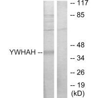 Western blot analysis of extracts from Jurkat cells, using 14-3-3 eta antibody. Western blot analysis of extracts from Jurkat cells, using 14-3-3 eta antibody.