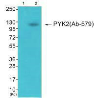 Western blot analysis of extracts from 3T3 cells (Lane 2), using PYK2 (Ab-579) antiobdy. The lane on the left is treated with synthesized peptide.