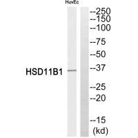 Western blot analysis of extracts from HuvEc cells, using HSD11B1 antibody. Western blot analysis of extracts from HuvEc cells, using HSD11B1 antibody.