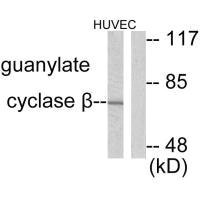 Western blot analysis of extracts from HuvEc cells, using Guanylate Cyclase beta antibody. Western blot analysis of extracts from HuvEc cells, using Guanylate Cyclase beta antibody.
