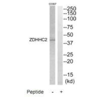 Western blot analysis of extracts from COS7 cells, using ZDHHC2 antibody. Western blot analysis of extracts from COS7 cells, using ZDHHC2 antibody.