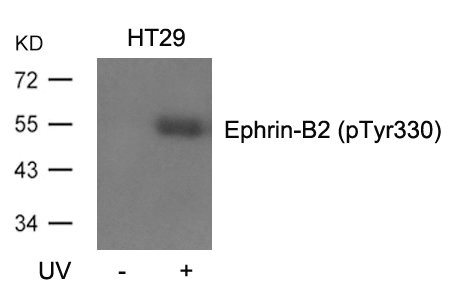 Western blot analysis of extracts from HT29 cells, untreated or treated with UV using Ephrin-B2(Phospho-Tyr330) Antibody. Western blot analysis of extracts from HT29 cells, untreated or treated with UV using Ephrin-B2(Phospho-Tyr330) Antibody.