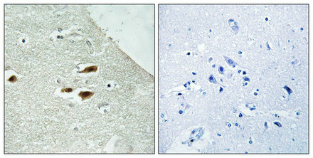 Immunohistochemistry analysis of paraffin-embedded human brain tissue using Period Circadian Protein 2 (Phospho-Ser662) antibody. The picture on the right is treated with the synthesized peptide.