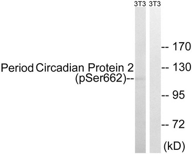 Western blot analysis of extracts from 3T3 cells, treated with PMA (125ng/ml, 30mins), using Period Circadian Protein 2 (Phospho-Ser662) antibody. The lane on the right is treated with the synthesized peptide. Western blot analysis of extracts from 3T3 cells, treated with PMA (125ng/ml, 30mins), using Period Circadian Protein 2 (Phospho-Ser662) antibody. The lane on the right is treated with the synthesized peptide.
