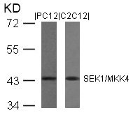 Western blot analysis of extracts from PC12 and C2C12 cells using SEK1/MKK4(Ab-80) Antibody.