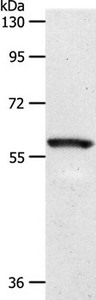 Gel: 10%SDS-PAGE Lysates (from left to right): Mouse eye tissue Amount of lysate: 40ug per lane Primary antibody: 1/1100 dilution Secondary antibody dilution: 1/8000 Exposure time: 2 seconds Gel: 10%SDS-PAGE Lysates (from left to right): Mouse eye tissue Amount of lysate: 40ug per lane Primary antibody: 1/1100 dilution Secondary antibody dilution: 1/8000 Exposure time: 2 seconds