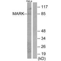 Western blot analysis of extracts from HeLa cells, using MARK antibody. Western blot analysis of extracts from HeLa cells, using MARK antibody.