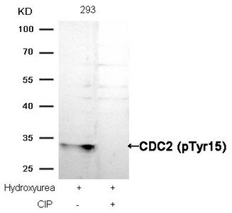 Western blot analysis of extracts from 293 cells, treated with Hydroxyurea or calf intestinal phosphatase (CIP), using CDC2 (Phospho-Tyr15) Antibody.