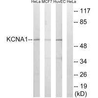 Western blot analysis of extracts from HeLa cells, MCF-7 cells and HuvEc cells, using KCNA1 antibody. Western blot analysis of extracts from HeLa cells, MCF-7 cells and HuvEc cells, using KCNA1 antibody.