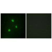 Immunofluorescence analysis of A549 cells, using TBX1 antibody.