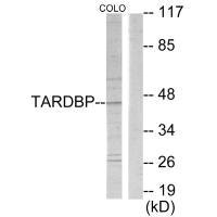 Western blot analysis of extracts from COLO205 cells, using TBX1 antibody. Western blot analysis of extracts from COLO205 cells, using TBX1 antibody.