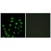 Immunofluorescence analysis of HepG2 cells, using SCAND1 antibody.