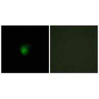 Immunofluorescence analysis of HepG2 cells, using SMG7 antibody.