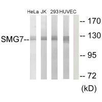 Western blot analysis of extracts from HeLa cells, Jurkat cells, 293 cells and HUVEC cells, using SMG7 antibody. Western blot analysis of extracts from HeLa cells, Jurkat cells, 293 cells and HUVEC cells, using SMG7 antibody.