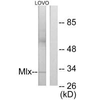 Western blot analysis of extracts from LOVO cells, using Mlx antibody. Western blot analysis of extracts from LOVO cells, using Mlx antibody.