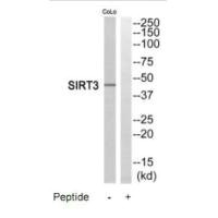 Western blot analysis of extracts from COLO205 cells, using SIRT3 antibody. Western blot analysis of extracts from COLO205 cells, using SIRT3 antibody.