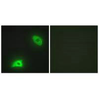 Immunofluorescence analysis of HeLa cells, using DUSP6 antibody.