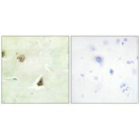 Immunohistochemistry analysis of paraffin-embedded human brain tissue, using DUSP6 antibody.