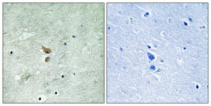 Immunohistochemistry analysis of paraffin-embedded human brain tissue using RIPK2 (Phospho-Ser176) antibody. The picture on the right is treated with the synthesized peptide.
