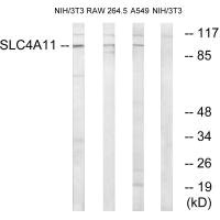 Western blot analysis of extracts from 3T3 cells, RAW264.7 cells and A549 cells, using SLC4A11 antibody. Western blot analysis of extracts from 3T3 cells, RAW264.7 cells and A549 cells, using SLC4A11 antibody.