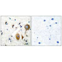 Immunohistochemical analysis of paraffin-embedded human brain tissue using GluR8 antibody. Immunohistochemical analysis of paraffin-embedded human brain tissue using GluR8 antibody.