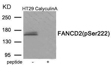 Western blot analysis of extracts from HT29 cells treated with CalyculinA using Phospho-FANCD2 (Ser222) antibody.The lane on the right is treated with the antigen-specific peptide. Western blot analysis of extracts from HT29 cells treated with CalyculinA using Phospho-FANCD2 (Ser222) antibody.The lane on the right is treated with the antigen-specific peptide.