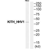Western blot analysis of extracts from HeLa cells, using KITH_HHV1 antibody. Western blot analysis of extracts from HeLa cells, using KITH_HHV1 antibody.