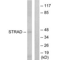 Western blot analysis of extracts from HepG2 cells, using STRAD antibody. Western blot analysis of extracts from HepG2 cells, using STRAD antibody.