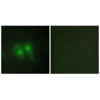 Immunofluorescence analysis of HeLa cells, using STEA3 antibody.