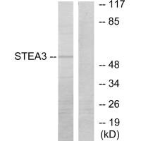 Western blot analysis of extracts from COLO205 cells, using STEA3 antibody. Western blot analysis of extracts from COLO205 cells, using STEA3 antibody.