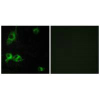 Immunofluorescence analysis of COS-7 cells, using LAMA1 antibody. Immunofluorescence analysis of COS-7 cells, using LAMA1 antibody.