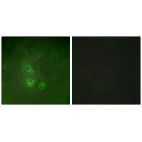 Immunofluorescence analysis of HUVEC cells, using FRK antibody.