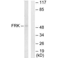 Western blot analysis of extracts from Jurkat cells, using FRK antibody. Western blot analysis of extracts from Jurkat cells, using FRK antibody.