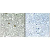 Immunohistochemistry analysis of paraffin-embedded human brain tissue using PIGH antibody. Immunohistochemistry analysis of paraffin-embedded human brain tissue using PIGH antibody.