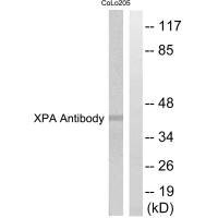 Western blot analysis of extracts from COLO205 cells, using XPA antibody.
