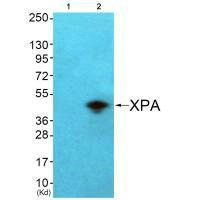 Western blot analysis of extracts from COS7 cells (Lane 2), using XPA antiobdy. The lane on the left is treated with systhesized peptide.
