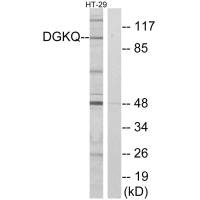 Western blot analysis of extracts from HT-29 cells, using DGKQ antibody. Western blot analysis of extracts from HT-29 cells, using DGKQ antibody.