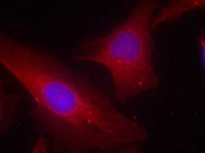 Immunofluorescence staining of methanol-fixed Hela cells using p56Dok-2(Ab-299) Antibody.