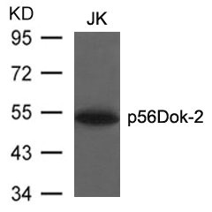 Western blot analysis of extracts from JK cells using p56Dok-2(Ab-299) Antibody. Western blot analysis of extracts from JK cells using p56Dok-2(Ab-299) Antibody.