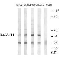 Western blot analysis of extracts from HepG2 cells, Jurkat cells, COLO cells and HUVEC cells, using B3GALT1 antibody. Western blot analysis of extracts from HepG2 cells, Jurkat cells, COLO cells and HUVEC cells, using B3GALT1 antibody.
