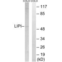 Western blot analysis of extracts from COLO cells, using LIPI antibody. Western blot analysis of extracts from COLO cells, using LIPI antibody.