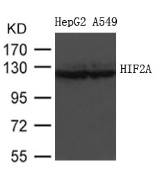 Western blot analysis of extracts from HepG2 and A549 cells using HIF2A Antibody. Western blot analysis of extracts from HepG2 and A549 cells using HIF2A Antibody.