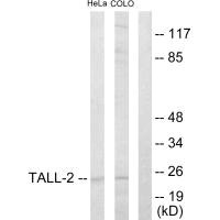 Western blot analysis of extracts from HeLa cells and COLO205 cells, using TALL-2 antibody. Western blot analysis of extracts from HeLa cells and COLO205 cells, using TALL-2 antibody.