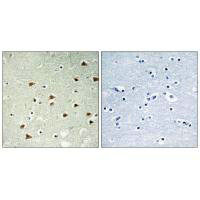 Immunohistochemistry analysis of paraffin-embedded human brain tissue using ABHD14B antibody. Immunohistochemistry analysis of paraffin-embedded human brain tissue using ABHD14B antibody.
